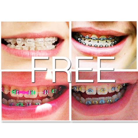 How To Make Diy Fake Braces How To Make Fake Braces Without Earring