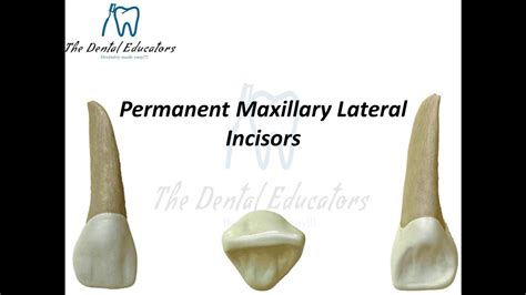 Permanent Maxillary Lateral Incisor Youtube