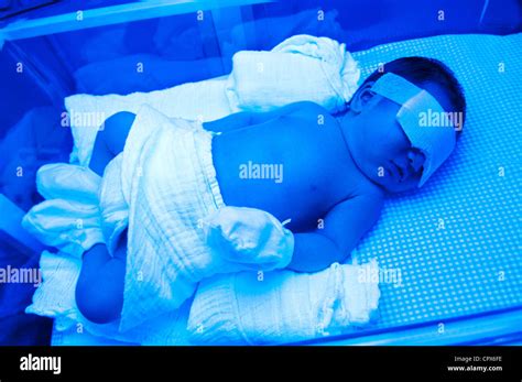 Newborn Baby With Jaundice Under Ultraviolet Light In The Incubator