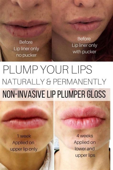 Plump Your Lips Naturally And Permanently Non Invasive Lip Plumper