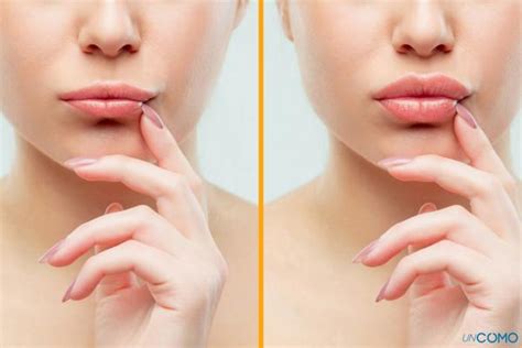 cómo aumentar los labios ¡descubre los mejores remedios naturales para que se vean más grandes