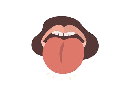 How To Reduce Swelling In Tongue Warexamination15