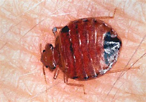 Dont Let The Bedbugs Bite Vigilance Awareness Needed When Taking On