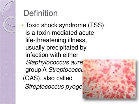 Toxic Shock Syndrome Rash Pictures Photos
