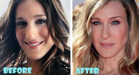 Sarah Jessica Parker Before And After Plastic Surgery Celebrity Plastic Surgery Online