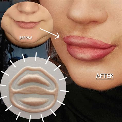 Lip Prostheticsenhanced Lips Botox Lips False Lips Doll Etsy