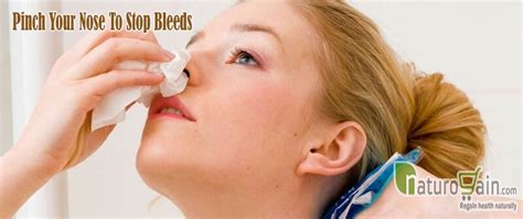 10 Home Remedies For Nose Bleeds To Stop Bleeding That Work Naturally