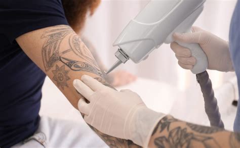 Get rid tattoo natural tattoo removal solution. ≡ Methods of Tattoo Removal 》 Life 360 Tips