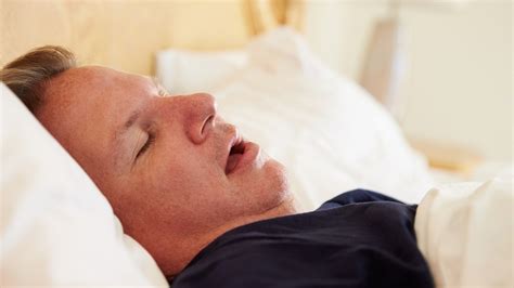Schlafapnoe Symptome Und Therapie Wissende