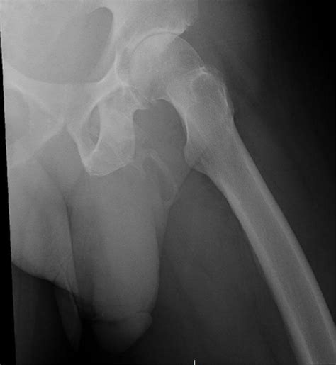 Doctors Take Hip X Ray Discover Patients Penis Is Literally Turning