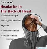 Images of Severe Headache Top Left Side Head