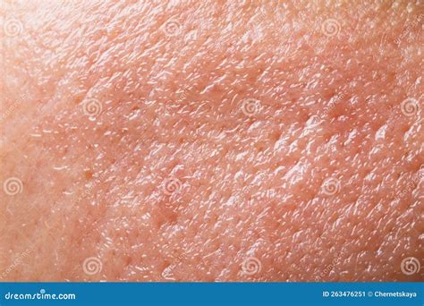 Closeup View Of Human Oily Skin As Background Stock Image Image Of