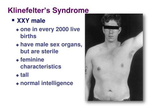 ppt chromosomal abnormalities in humans powerpoint presentation free 53040 hot sex picture