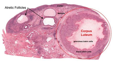 Ovary Cs Corpus Luteum Ovaries Lutein