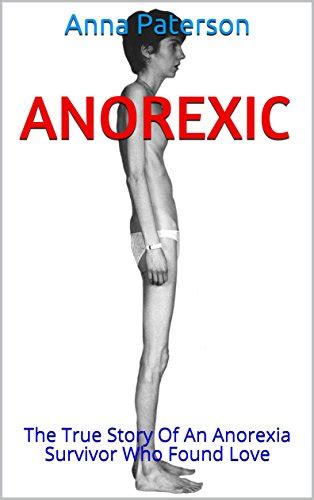 Jp Anorexic The True Story Of An Anorexia Survivor Who Found Love English Edition