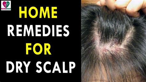 Home Remedies For Dry Scalp Health Sutra Best Health Tips Youtube