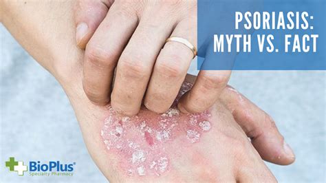 Video Psoriasis Myth Vs Fact