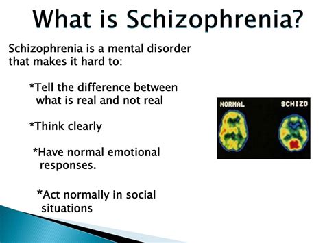 Ppt Schizophrenia Powerpoint Presentation Free Download Id2058550