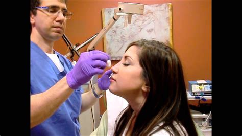 Non Surgical Nyc Nose Jobs Without Any Surgery Doctors Tips Online