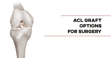 Acl Reconstruction Surgery Graft Options