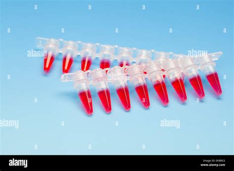 Blood Screening For The Aids Virus Stock Photo Alamy