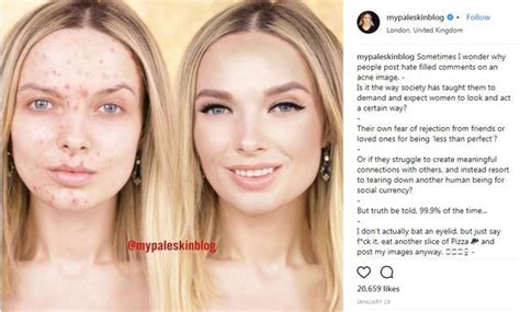 Skin Positivity The Biggest Beauty Trend Of 2018 Has People Posting