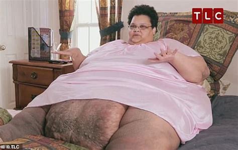 Morbidly Obese Woman Who Was Bedridden For Three Years Sheds Lbs And