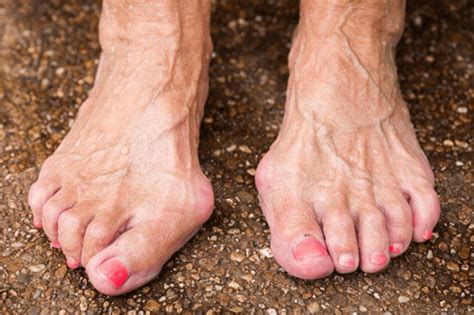 Fortworthfootdoctor Fort Worth Podiatrist