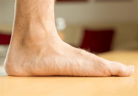 Pronation And Flat Feet Foot Mechanics