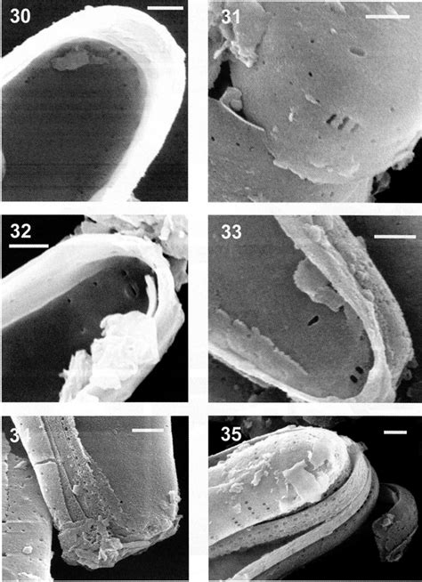 Sem Images Of Synedropsis Cheethamii All Images From Crf 22a
