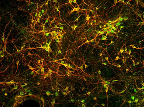 Animal cell culture their maintenance and preservation. Primary Neurons and Glial Cells | Lonza
