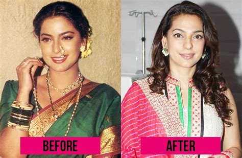 12 Bollywood Plastic Surgeries That Horribly Went Wrong