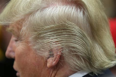 Donald Trumps Hair Scalp Reduction And Just For Men The Washington