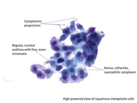 9b Normal Cytology And Benign Reactive Changes Eurocytology