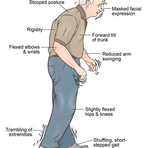 What Body Systems Are Affected By Parkinson S Disease