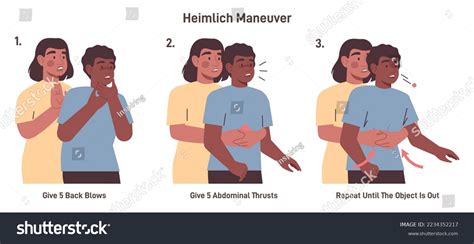 Choking First Aid Adult Heimlich Maneuver Vector Có Sẵn Miễn Phí Bản Quyền 2234352217