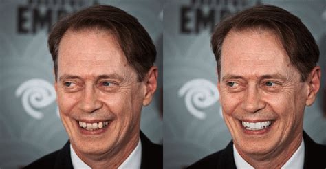 Get Steve Buscemi Teeth Pics Cante Gallery