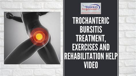 Trochanteric Bursitis Treatment Exercises And Rehabilitation Help Video