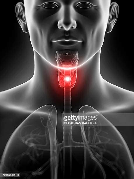 Swollen Glands Photos And Premium High Res Pictures Getty Images