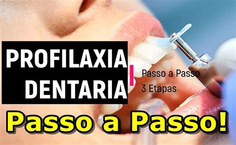 Profilaxia DentÁria 3 Etapas Passo A Passo Odontofarma
