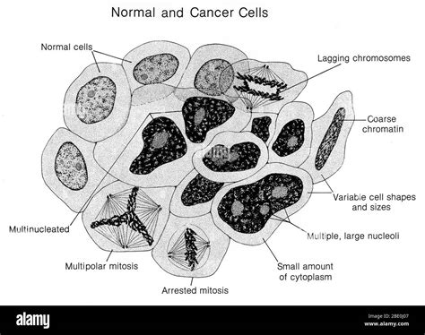 Histopatologia Tumores Fotograf As E Im Genes De Alta Resoluci N Alamy
