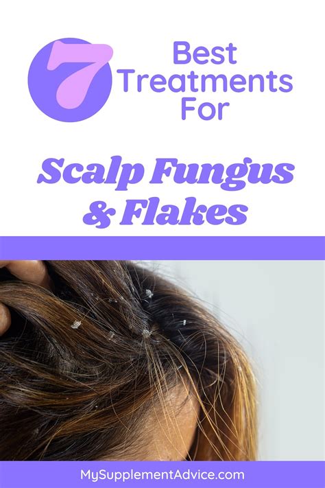 How To Get Rid Of Scalp Fungus Flakes In 7 Steps Artofit