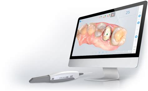 Introducing Digital Dentistry To Your Practice Via Intraoral Scanning