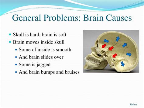 Ppt The Impact Of Brain Injury Mechanisms Of Damage Deficit