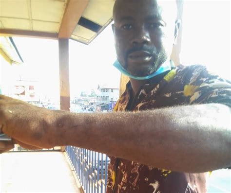 Sierra Leone Journalist Alusine Antha Beaten While Covering Land Dispute Committee To Protect