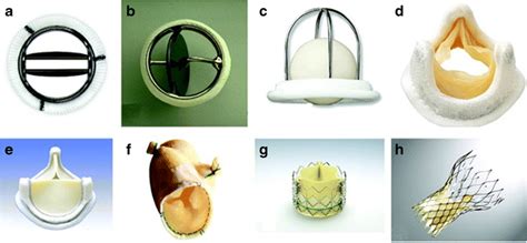 Different Types Of Prosthetic Valves A Bileaflet Mechanical Valve St