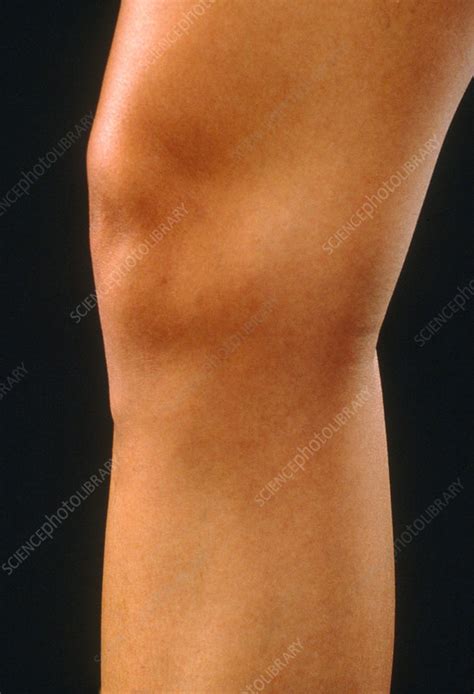 Female Knee Stock Image C0034425 Science Photo Library