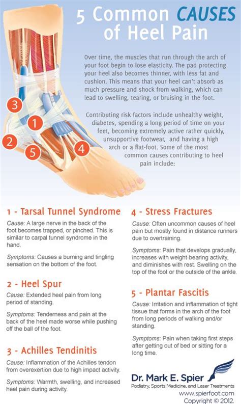 Foot Pain Chart Top Of Foot