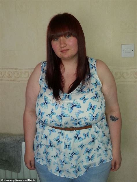 Woman Rejected For Nhs Breast Reduction Surgery Goes Down Cup Sizes Worldlifestylenews Com