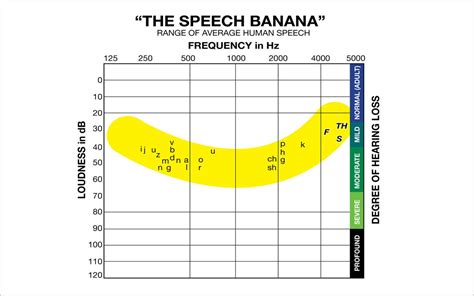 Whether or not speech therapy would have great outcomes depends primarily on the type and degree of hearing loss the person is suffering from, and secondarily on the fact that whether the person is born deaf, or have developed hearing loss later. What You Need to Know About the Speech Banana | Helping Me ...